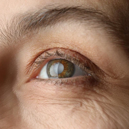 The Effects of Aging on Natural Lashes